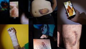 Golpeadas en las cargas policiales de La Vuelta: “Por supuesto que volvería”